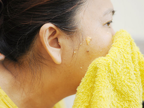 Tạm biệt làn da sần như gai mít nhờ dứa và đu đủ - 9