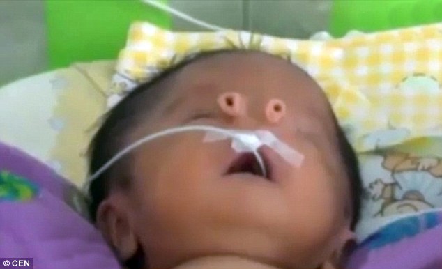 Video: Cậu bé không có mũi chào đời ở Peru - 1