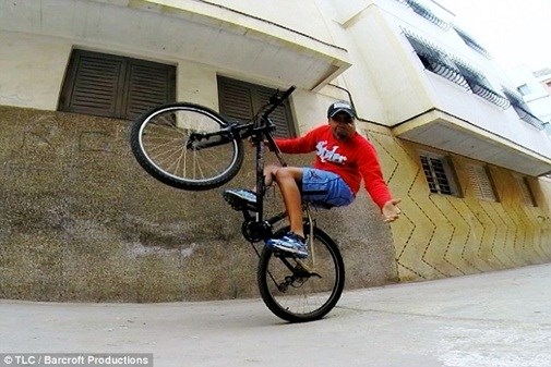 Xót thương chàng trai mang “bom nổ chậm” trên mặt - 6