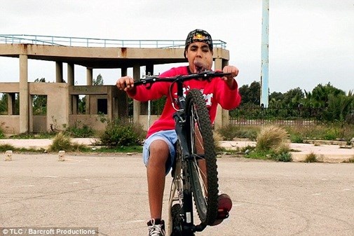 Xót thương chàng trai mang “bom nổ chậm” trên mặt - 5