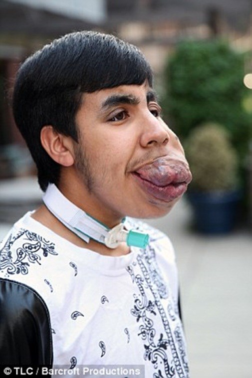 Xót thương chàng trai mang “bom nổ chậm” trên mặt - 3