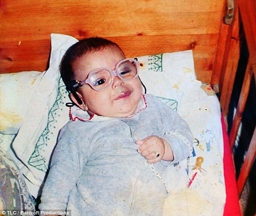 Xót thương chàng trai mang “bom nổ chậm” trên mặt - 2