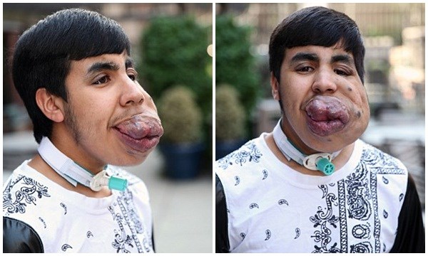 Xót thương chàng trai mang “bom nổ chậm” trên mặt - 1