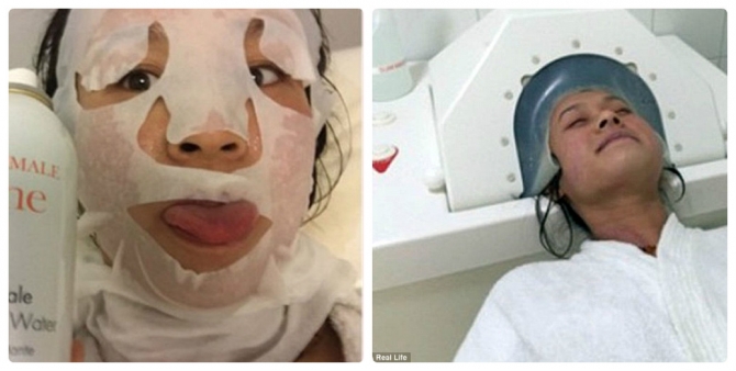 Thiếu nữ bị bong tróc da khắp người sau khi nâng ngực - 5