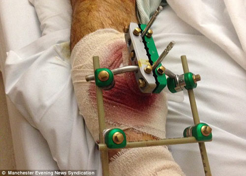 Lĩnh án tù vì đá bạo lực còn chửi rủa nạn nhân - 3