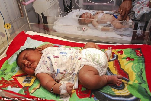 Ấn Độ: Bé sơ sinh nặng gần 6kg - 1
