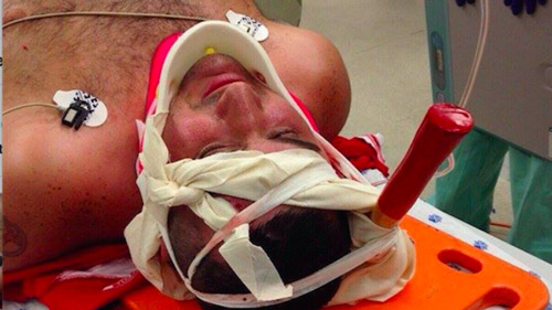 Fan đi xem bóng đá, bị rìu bửa vào đầu - 1