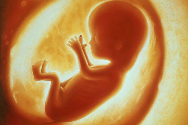 Phát hiện bào thai trong bụng bé trai 4 tuổi - 1