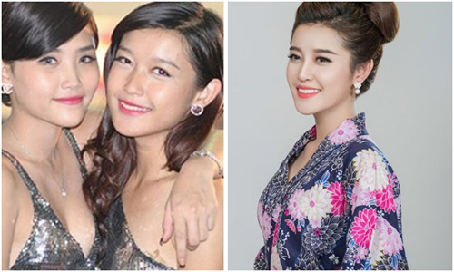 Bờ môi gợi cảm của Á hậu Huyền My sau 1 năm đăng quang - 2