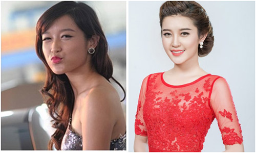 Bờ môi gợi cảm của Á hậu Huyền My sau 1 năm đăng quang - 4