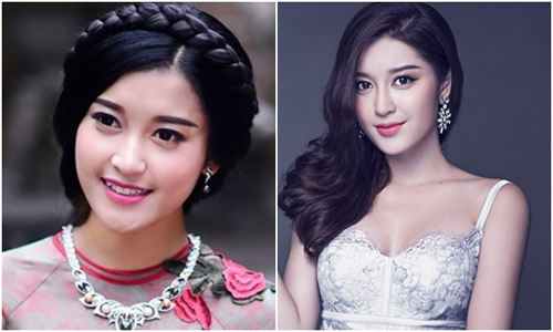 Bờ môi gợi cảm của Á hậu Huyền My sau 1 năm đăng quang - 6