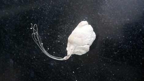 Phát hiện cước câu cá trong… niệu đạo thiếu niên - 1