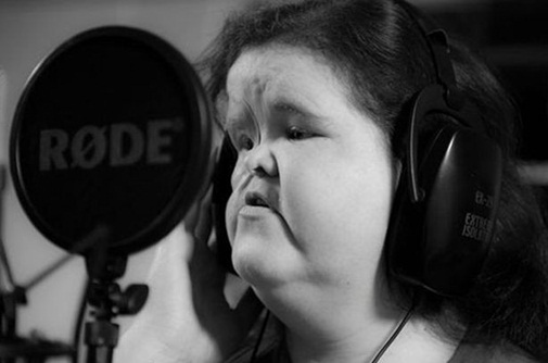 Cảm phục nghị lực sống của cô gái bị biến dạng khuôn mặt - 2