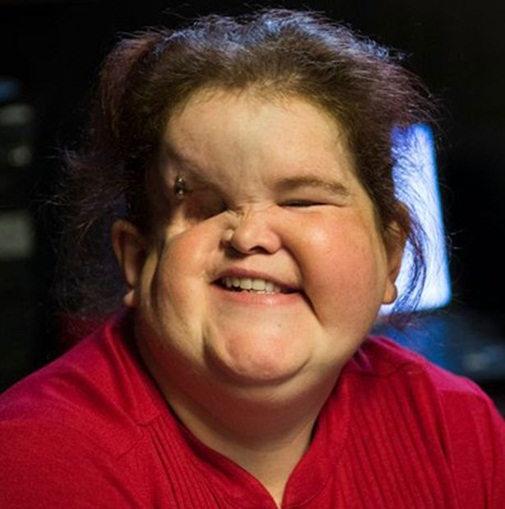 Cảm phục nghị lực sống của cô gái bị biến dạng khuôn mặt - 3