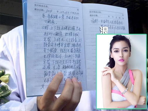 Huỳnh Hiểu Minh nói về nhan sắc gây ầm ĩ của Angelababy - 2