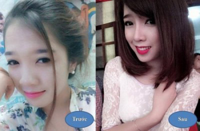 “Độc chiêu” dành tặng nàng có mũi cà chua - 5