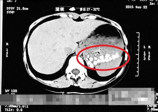 Truyền hình TQ: "Trân châu trà sữa làm từ da giày, lốp xe cũ" - 1