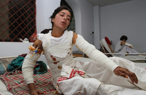 Pakistan: Thiếu nữ bị thiêu sống vì từ chối lời cầu hôn - 1