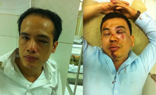 Tướng Nguyễn Đức Chung: Phải làm cho ra vụ đánh 2 luật sư - 2