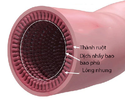 Cách chữa viêm đại tràng mới nhất - 2