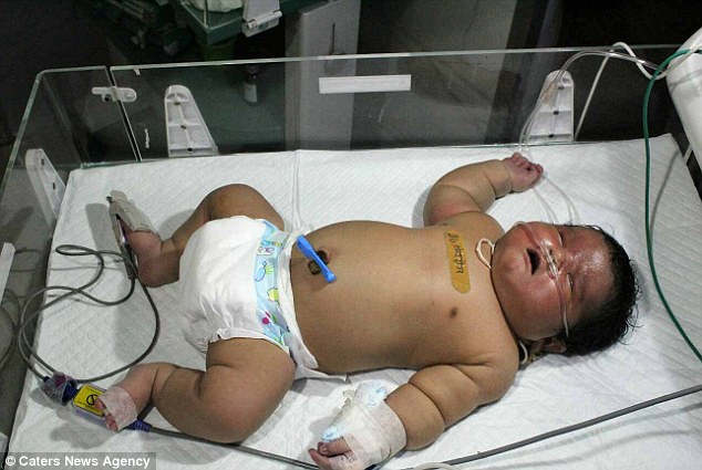 Chuyện lạ về bé sơ sinh có cân nặng 7kg ở Ấn Độ - 1