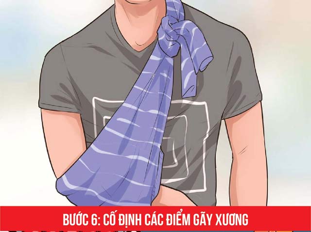 Cần làm gì khi cấp cứu người bị tai nạn giao thông? - 6