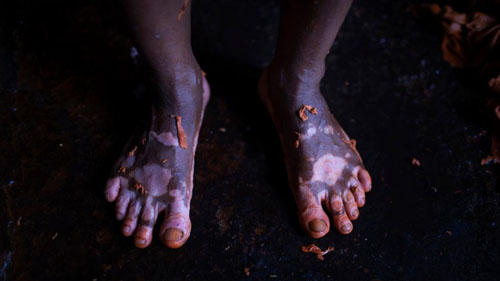 Ảnh: Sống trong cảnh ô nhiễm dễ sợ ở Bangladesh - 9