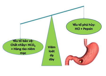 Chữa đau dạ dày: Chỉ riêng tinh nghệ Nano chưa đủ? - 1