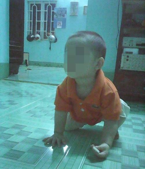 Bé 22 tháng tuổi thương tích đầy mình sau 2 ngày đi học - 1