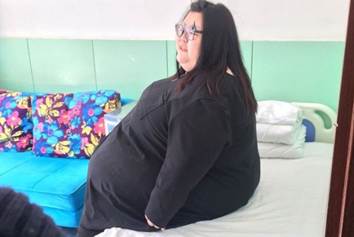 Cô gái béo nhất TQ cắt bớt dạ dày để giảm cân - 1