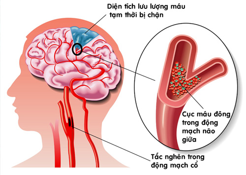 Công dụng kỳ diệu của lá sen - 3