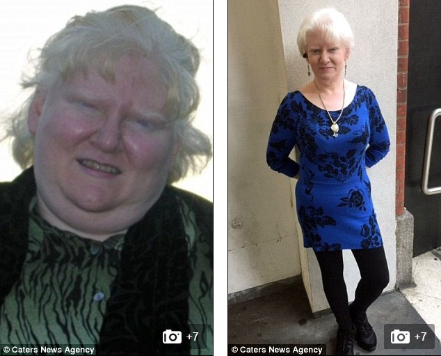 Bà mẹ giảm gần 100kg nhờ tập thái cực quyền và buộc dạ dày - 1