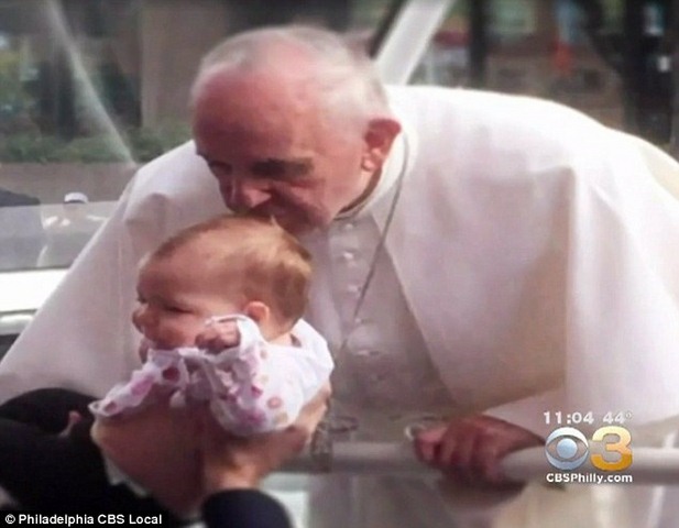 Nụ hôn Giáo hoàng giúp teo u não bé gái 1 tuổi - 1
