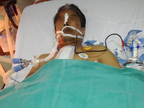Xe ôm bị cướp đâm dao xuyên gáy xuống tim - 2
