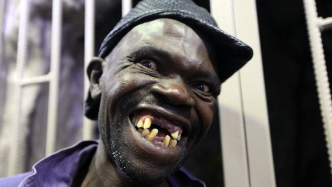 Người đàn ông xấu nhất Zimbabwe bị chê... quá đẹp trai - 1