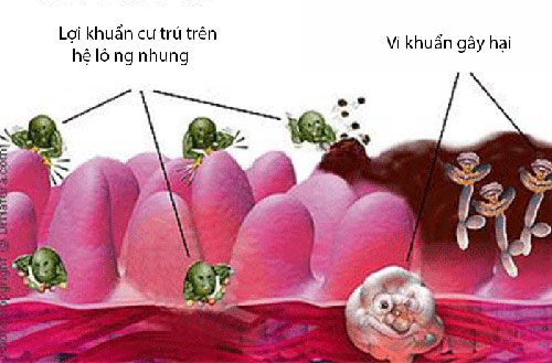 Uống thuốc gì khi bị viêm đại tràng - 2