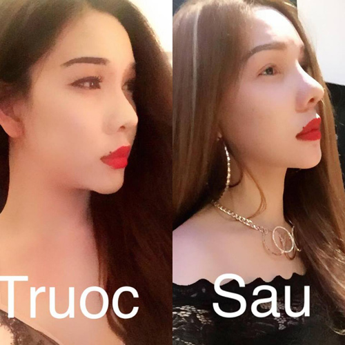 Mẫu chuyển giới Việt “xinh như mộng” sau khi sửa mũi - 4