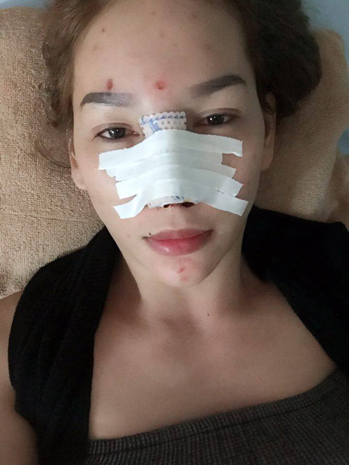 Mẫu chuyển giới Việt “xinh như mộng” sau khi sửa mũi - 3