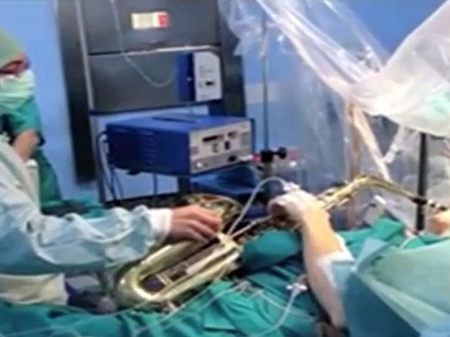 Bệnh nhân chơi saxophone khi đang mổ não suốt 12 tiếng - 1