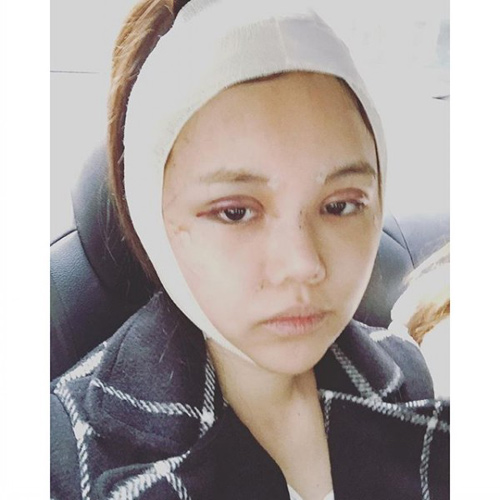 Mỹ nhân Singapore bị la ó vì “dao kéo” sớm sau sinh - 1