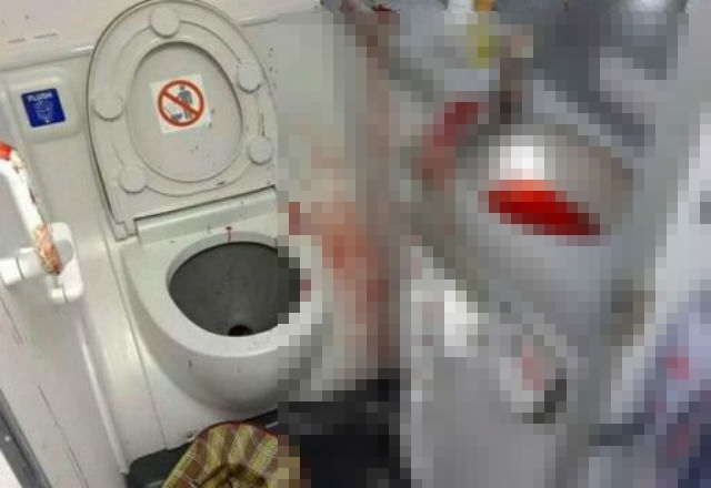TQ: Đập đầu vào bồn rửa toilet máy bay tự tử - 1