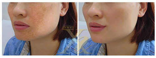 Đón năm mới, nhận quà từ Thẩm mỹ viện Xuân Hương - 2