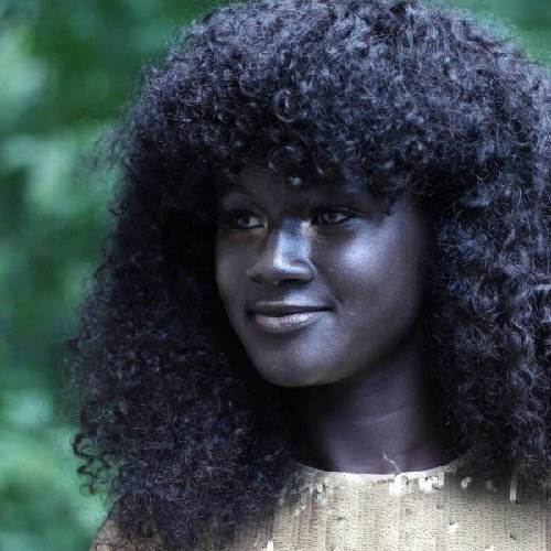 Cô gái trẻ có làn da đen kỳ lạ nhất thế giới - 1
