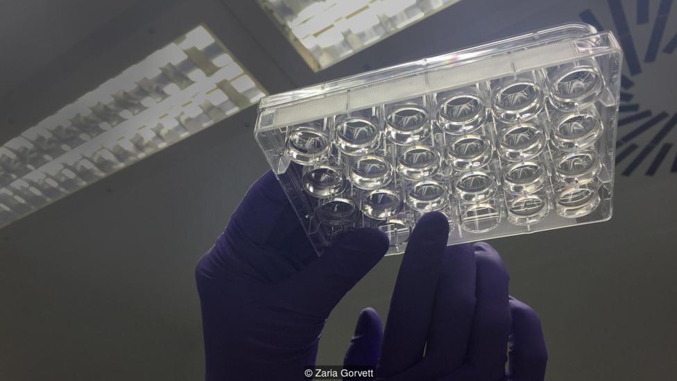 Có thể nuôi não người biết suy nghĩ ngoài cơ thể? - 3