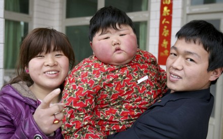 Trung Quốc sắp dẫn đầu thế giới về  trẻ em béo phì - 1