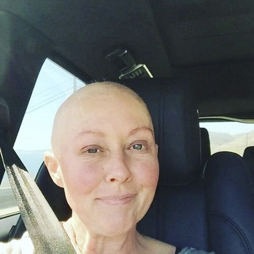 Fan xót xa sao nữ bị hủy hoại nhan sắc vì mắc ung thư - 1