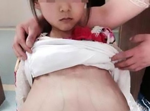 Bé gái Việt 12 tuổi có thai ở TQ: Lộ giá bán cho &#34;chồng&#34; - 2