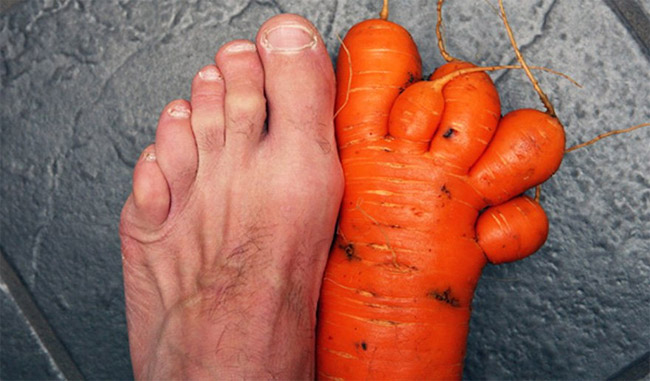 Nhìn củ cà rốt với bàn chân có khác gì nhau đâu?