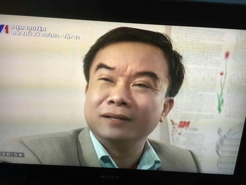 Sao phim “Thời xa vắng” bị ung thư gan, sụt 15kg/tháng - 1