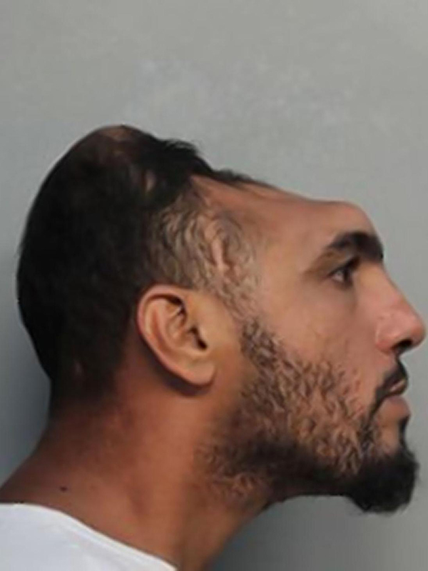 Mỹ: Giật mình với tên tội phạm chỉ có nửa đầu - 2